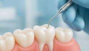 Dolgu Tedavisi Görsel 1