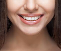 Gülüş Tasarımı Görsel 2