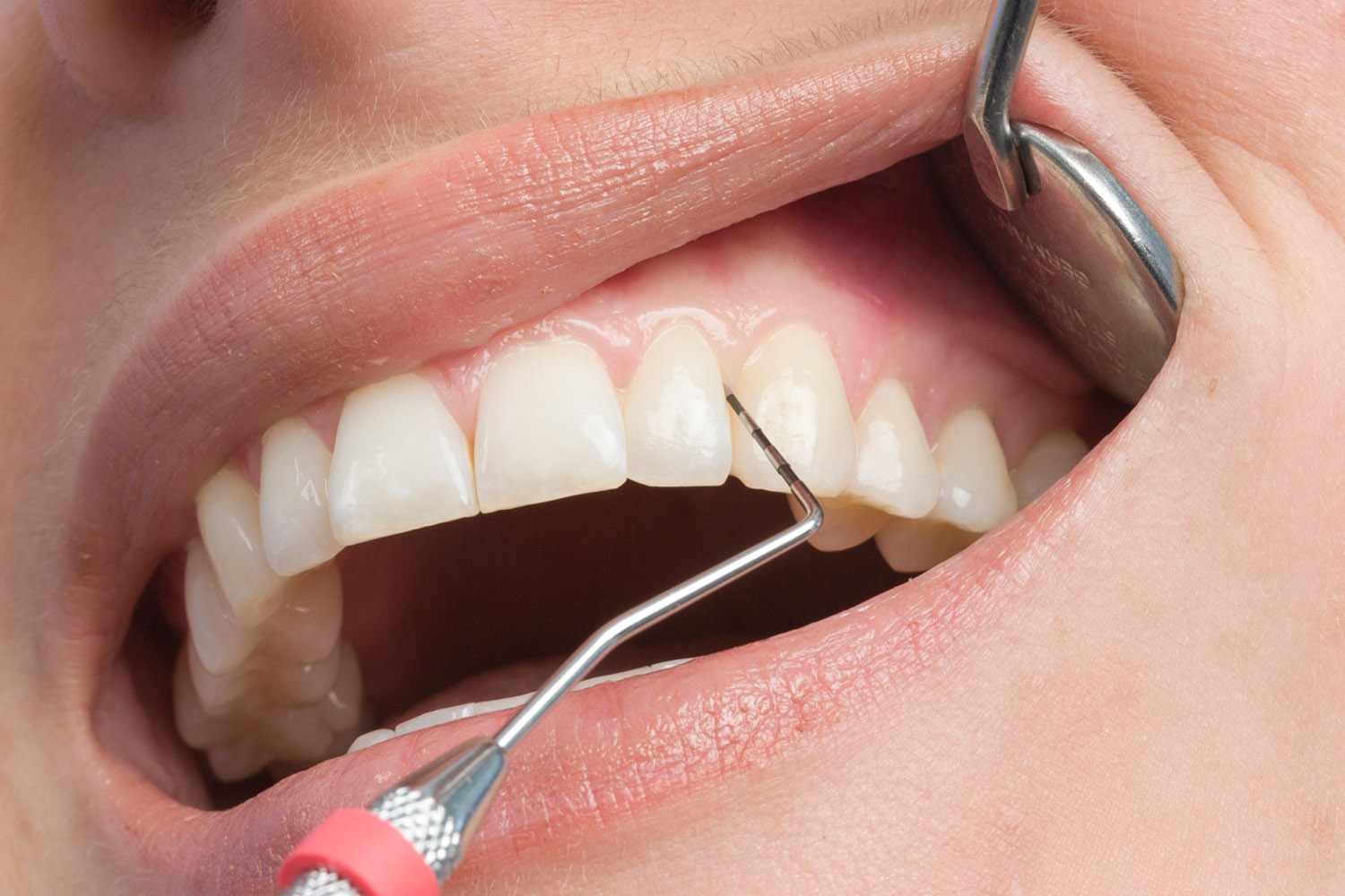 Periodontoloji Görsel 2